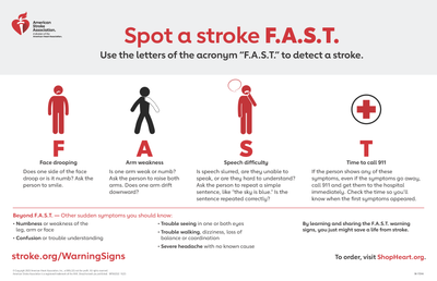 Stroke Warning Signs Posters (3) - Bilingual